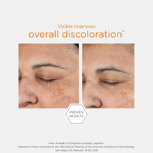 Load image into Gallery viewer, Before and after comparison of facial skin with text indicating improvement in discoloration.