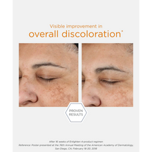 Load image into Gallery viewer, Side-by-side clinical before and after photos of a person's face showing visible improvement in skin discoloration after using the NeoStrata Enlighten 4-product regimen for 16 weeks.