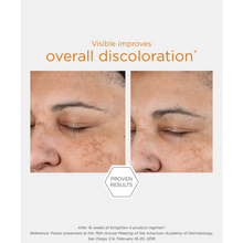 Load image into Gallery viewer, Side-by-side clinical before and after photos of a jawline at Week 0 and Week 12, showing visible improvement in skin discoloration after using the NeoStrata Enlighten regimen.