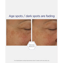 Load image into Gallery viewer, A before and after comparison showing the fading of age spots and dark spots on a person's cheek. The images are labeled with text stating age spots and dark spots are fading, with a footnote mentioning improvement after 12 weeks of once daily use.