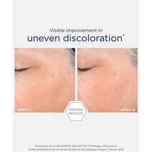 Load image into Gallery viewer, Before and after comparison showing visible improvement in uneven skin discoloration after 12 weeks of using NeoStrata Tri-Therapy Lifting Serum.