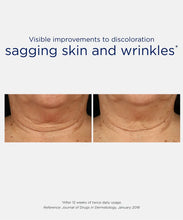 Load image into Gallery viewer, Clinical before and after results of Neostrata Triple Firming Neck Cream showing a visible reduction in neck wrinkles and sagging skin after 12 weeks.