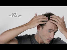 Load and play video in Gallery viewer, CRESCINA HFSC Complete Treatment | Man