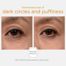 Load image into Gallery viewer, Before and after comparison of dark circles and puffiness with text indicating proven results.
