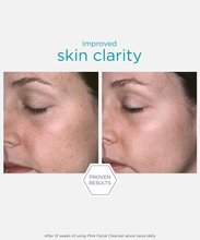 Load image into Gallery viewer, PHA Facial Cleanser
