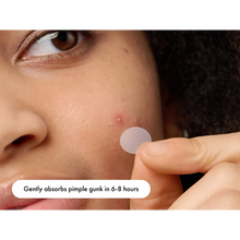Load image into Gallery viewer, A person applying a clear hydrocolloid pimple patch onto a whitehead on their cheek.
