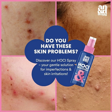 Load image into Gallery viewer, Before and after comparison photos showing skin imperfections and irritations being treated with HOCl Spray.
