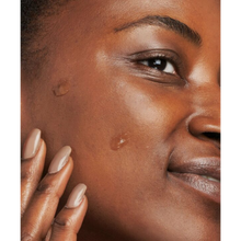 Load image into Gallery viewer, Close-up of a person with clear, radiant skin applying dots of NeoStrata Enlighten Dark Spot Corrector gel to their cheek to target areas of discoloration.
