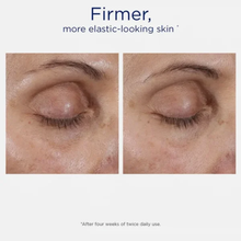 Load image into Gallery viewer, Before and after comparison of the under-eye area showing firmer, more elastic-looking skin after four weeks of using Neostrata Intensive Eye Therapy.
