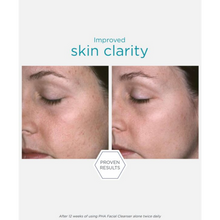 Load image into Gallery viewer, A before-and-after comparison showing improved skin clarity on a person's cheek and under-eye area. A "PROVEN RESULTS" hexagon is centered below the images, noting results after 12 weeks of twice-daily use.
