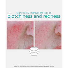 Load image into Gallery viewer, Clinical before and after comparison showing visible reduction in facial blotchiness and redness after 2 weeks of using NeoStrata Restore Redness Neutralizing Serum.
