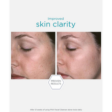 Load image into Gallery viewer, A before-and-after split image showing "Improved skin clarity" on a person's face. A "PROVEN RESULTS" hexagon is centered below the comparison, which notes results after 12 weeks of twice daily use.

