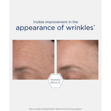 Load image into Gallery viewer, Before and after comparison showing visible improvement in forehead wrinkles after 16 weeks of NeoStrata Skin Active Firming regimen.
